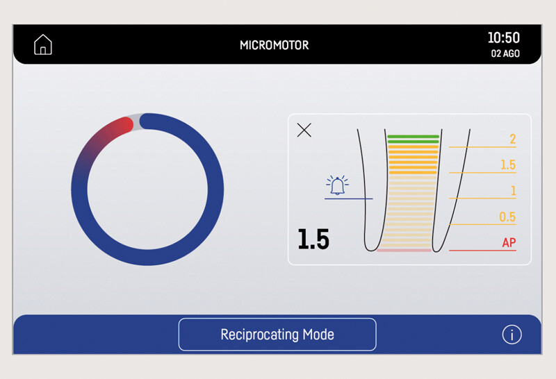 modalita-reciprocante