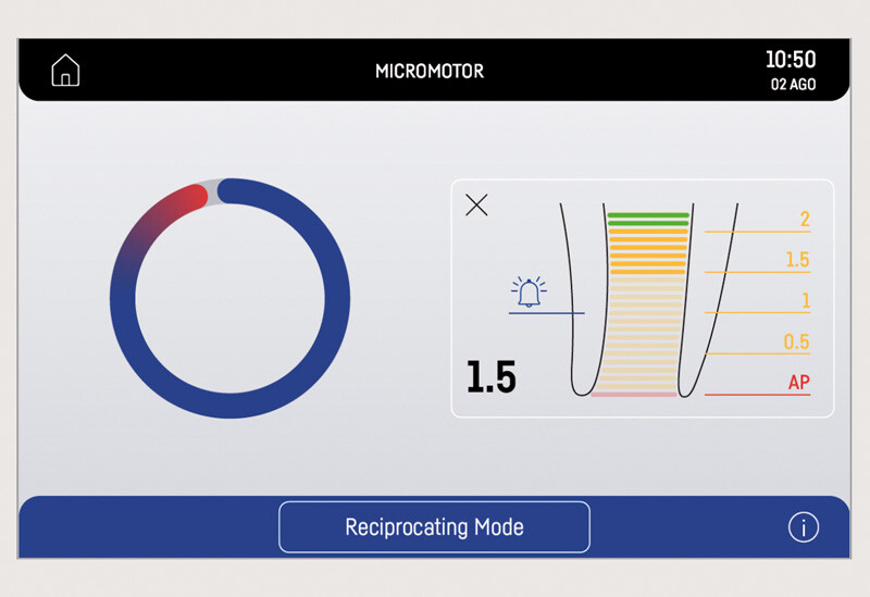 modalita-reciprocante